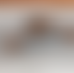 Ansiedade leve no dia a dia