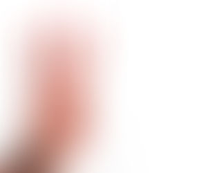 LAC-CANINUM - бородавки, колено и мигрень