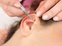ear seeding.jpg