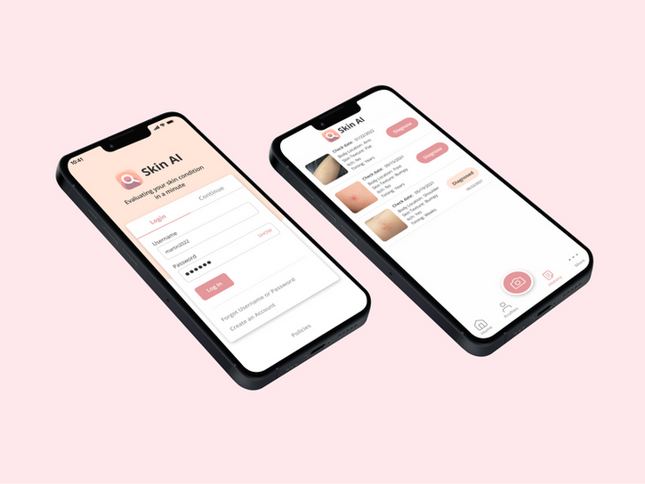 Skin AI