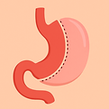 gastric_sleeve.png