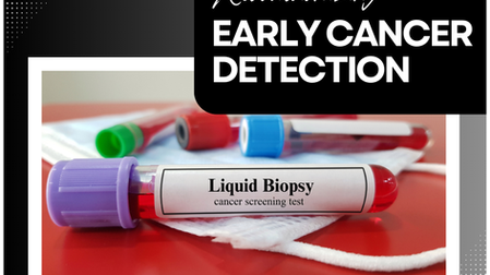 Liquid Biopsies: Revolutionizing Early Cancer Detection