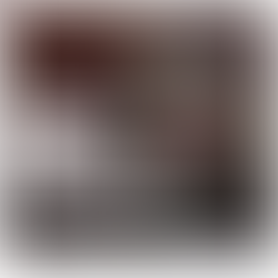 Robotic Kidney Transplants: Combining Precision and Innovation