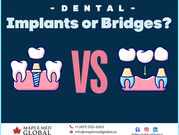 Implants or Bridges: Which Option is Right for You?