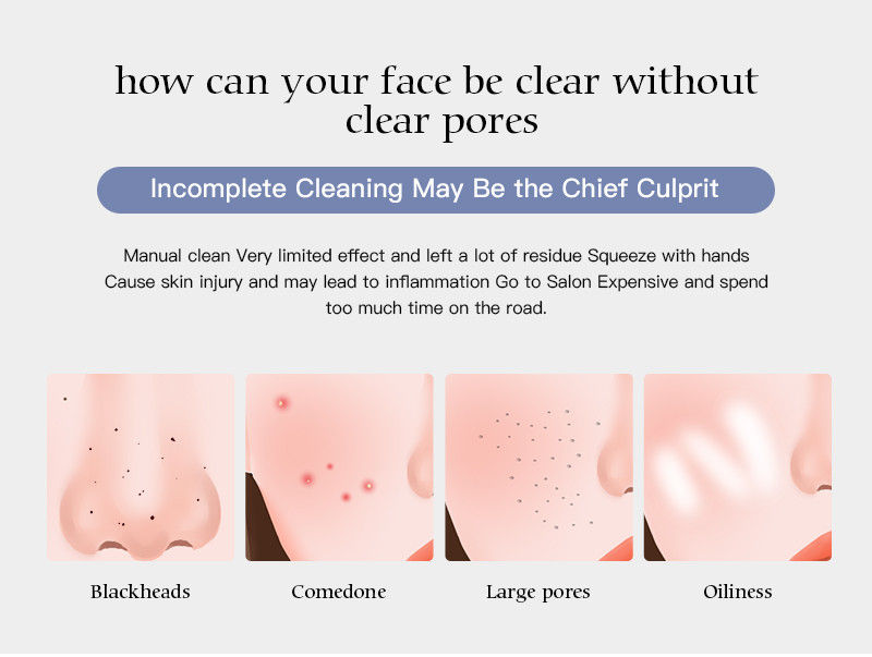 Thumbnail: Xpreen 冷暖吸黑頭粉刺機 XPRE129