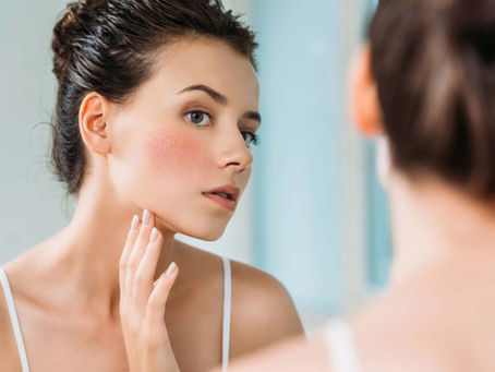 What is sensitive skin?