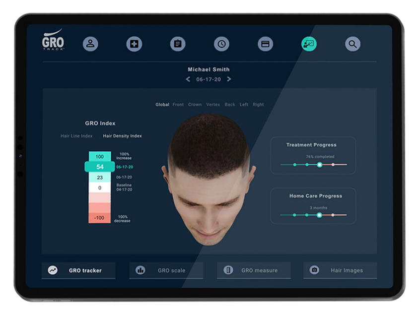 En el distinguido Perfectly Bare Laser MedSpa de Tampa, la herramienta de análisis del cabello GroTrac está revolucionando el enfoque del cuidado y la restauración del cabello. Este dispositivo de última generación proporciona evaluaciones precisas y en profundidad de la salud, la densidad y los patrones de crecimiento del cabello. Al aprovechar las métricas precisas de GroTrac, los profesionales de Perfectly Bare Laser pueden diseñar planes de tratamiento altamente personalizados adaptados a las necesidades únicas de cada individuo. Esta fusión de tecnología y experiencia garantiza que los clientes reciban no solo tratamientos, sino también soluciones basadas en resultados para sus problemas capilares. Sumérgete en el futuro del cuidado integral del cabello y experimenta conocimientos incomparables sobre la salud de tu cabello con GroTrac en Perfectly Bare Laser MedSpa.