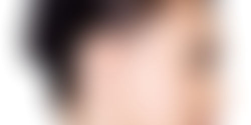 Reshape Your Ears with Otoplasty in Order to Create a New Look