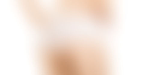 Brazilian Butt Augmentation with Fat Transfer