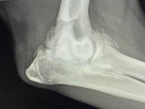 Arthritis Clinic
