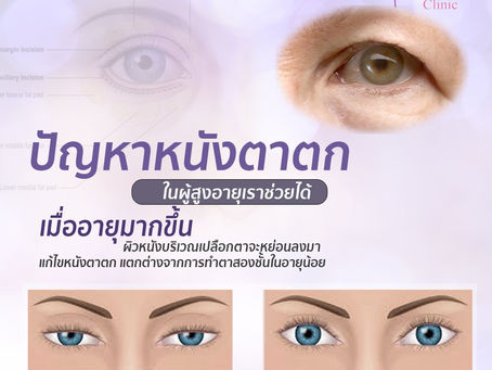 ปัญหาหนังตาตก ในผู้สูงอายุ
