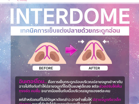 INTERDOME เทคนิคการเย็บปลายด้วยกระดูกอ่อน