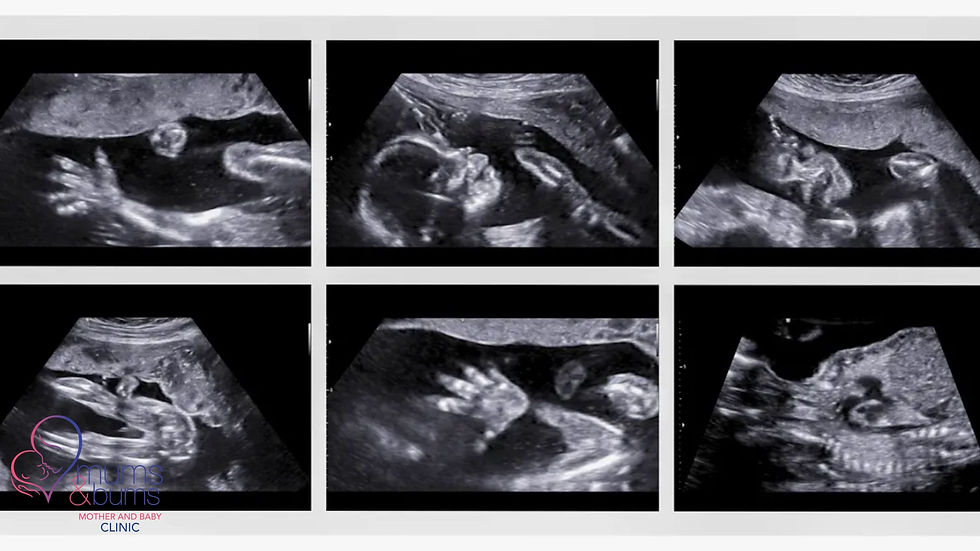 20-week anatomy scan showing baby’s face, spine, and limbs, detailed ultrasound in South Africa.