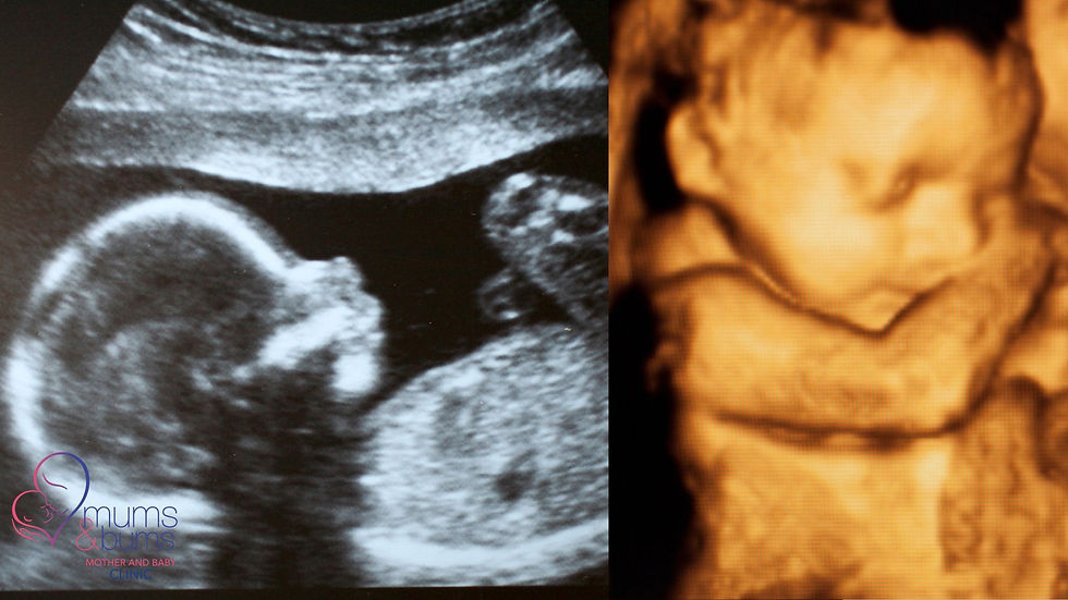 3rd trimester 2D and 4D ultrasound comparison showing baby’s face. Pregnancy scan South Africa.