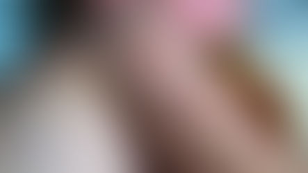 Child with measles rash on arm and face during 2025 Tshwane outbreak – Mums & Bums Clinic South Africa