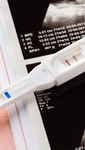 Positive pregnancy test and ultrasound with Mums & Bums Clinic Centurion logo.