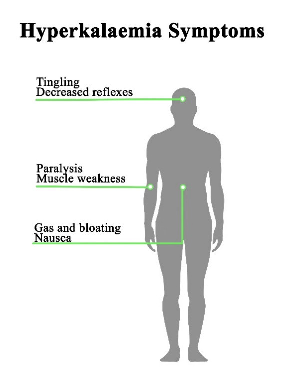 Potassium Abnormalities And Hyperkalemia Patient Handout