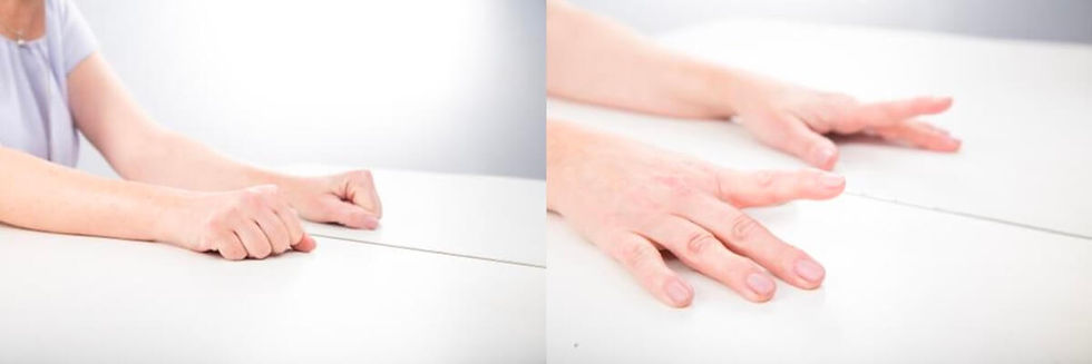 Mirror Therapy for Phantom Limb Pain and Stroke