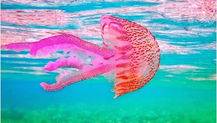 Mauve Stinger Jellyfish (Pelagia noctiluca) Envenomation