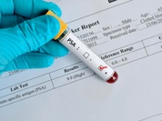 CME: Prostate Cancer - To Test or Not to Test, That Is the Question.