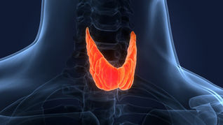 Subclinical Hypothyroidism