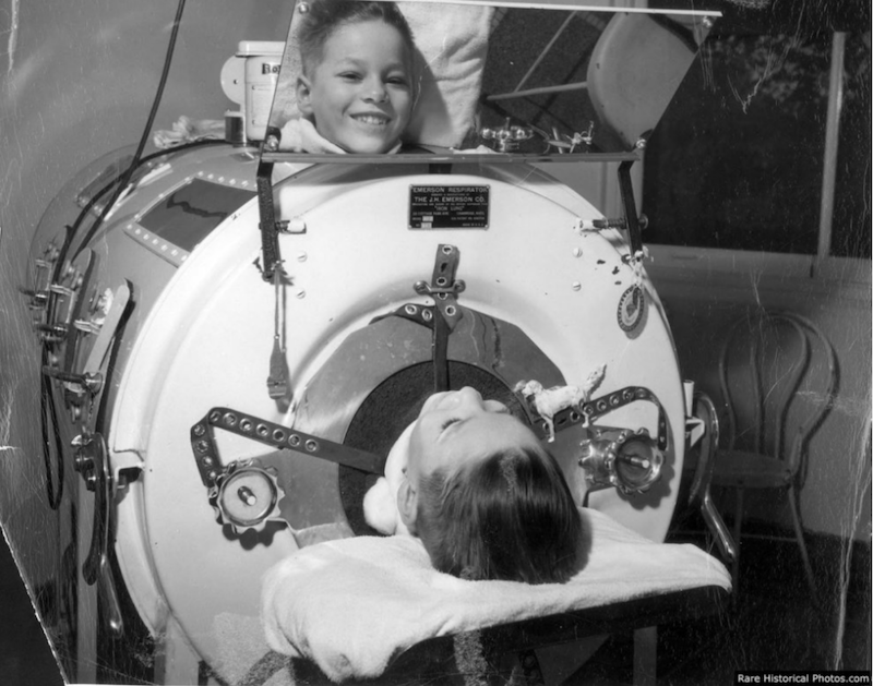 Child with Polio in an Iron Lung