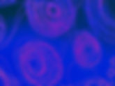 Tuberculosis: Latent TB