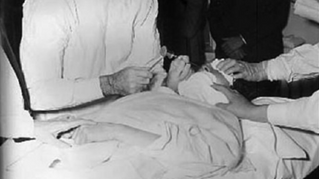 lobotomy surgery