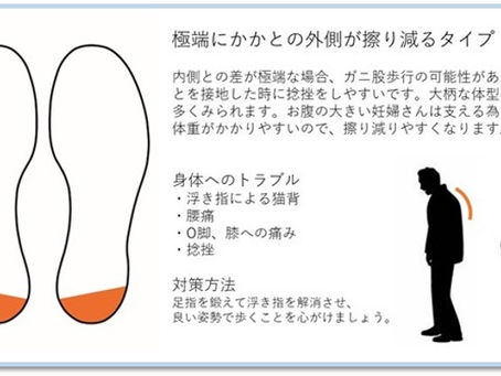 【コラム19】靴からわかるトラブル注意報!