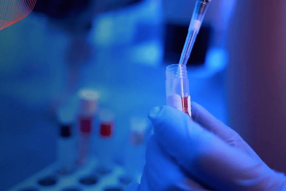 Proteomics International Laboratories diabetes test reshapes how doctors manage kidney risk