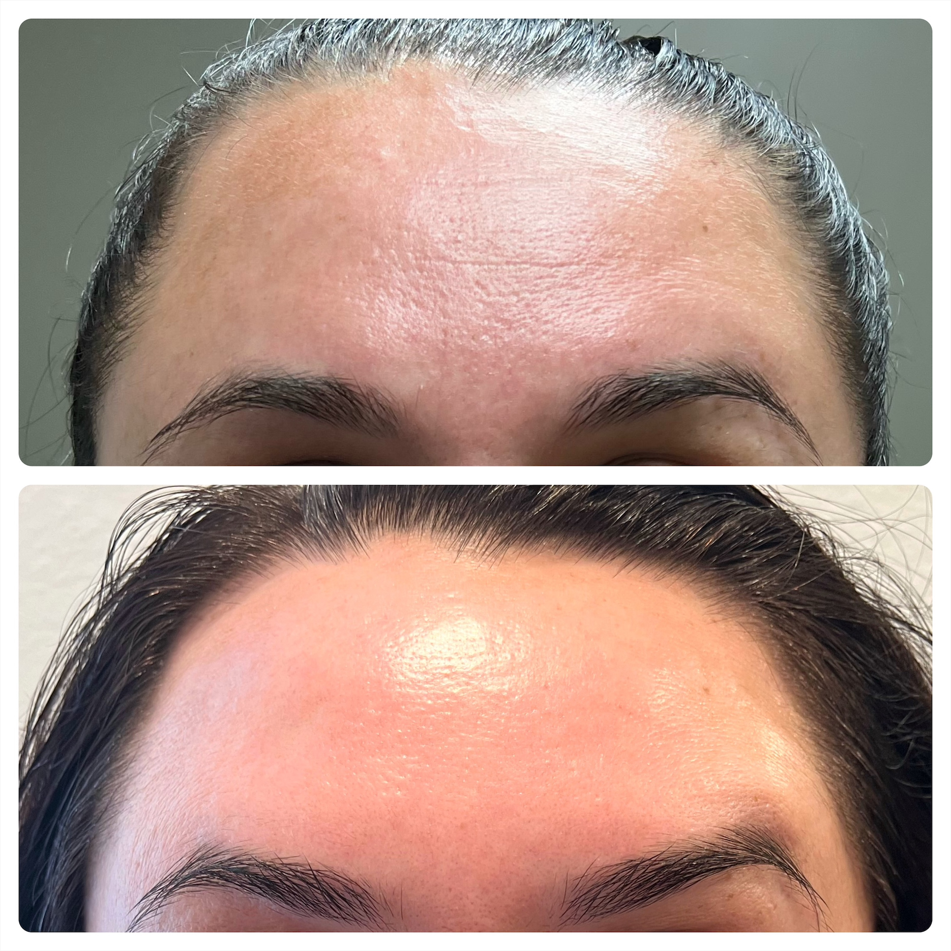 Before and after sensitive skin transformation at Kennedy Skincare in Newport Beach