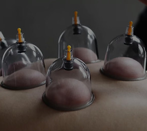 Cupping-0708-1280x500-1_edited.jpg