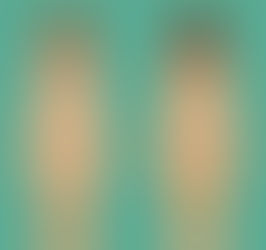 Pilates é um alívio para pessoas com Fibromialgia