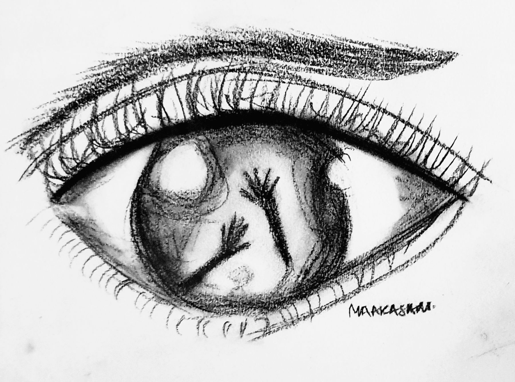 Eye