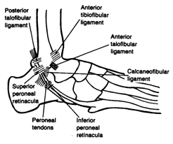 ANKLE SPRAINS
(Lateral Ligament Sprains)