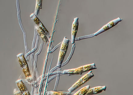 Sceptronema orientale, a diatom specific to growing on the copepod Euterpina