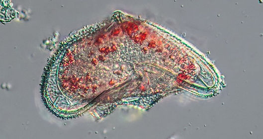 Protopteridinium stk1.jpg