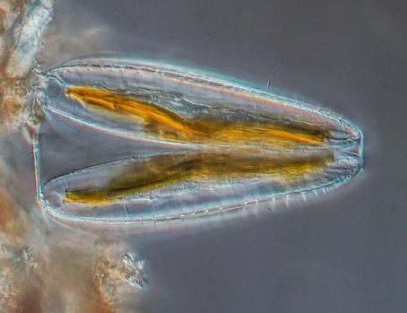 Surirella gemma diatom