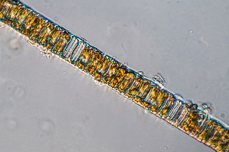 Paralia sulcata chain of diatoms