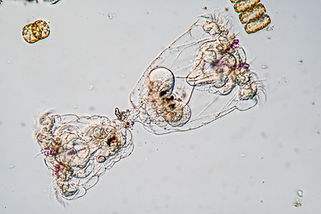 Rotifers - Synchaeta, pair