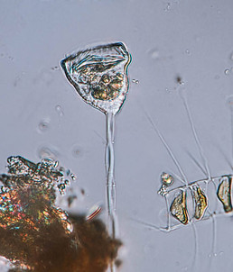 Vorticella
