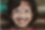 Niña con vitiligo en cara