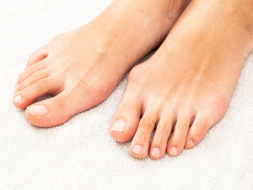 What to Expect From Your Bunion Correction Surgery