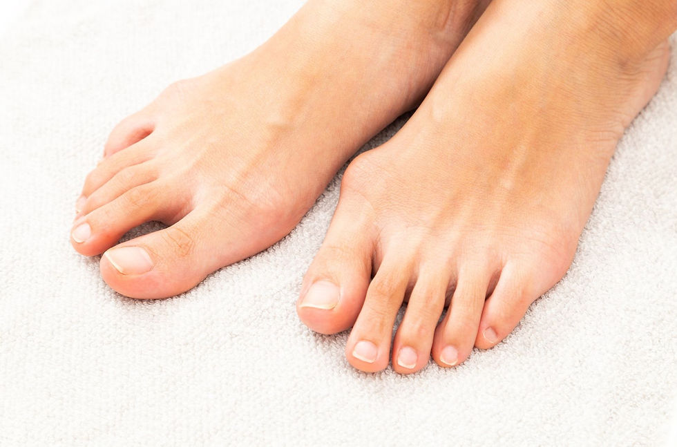 What to Expect From Your Bunion Correction Surgery