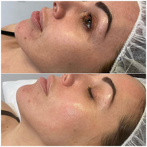 JetPeel -before and after (2).jpeg