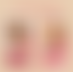 Le MATCH : Frites Maison ou Industrielles ?