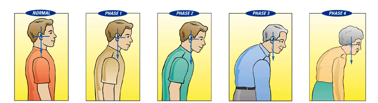 Posture with aging