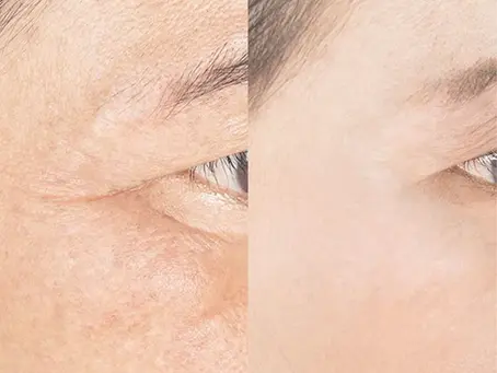 The Glow Peptide: Your Inside-Out Skin Upgrade