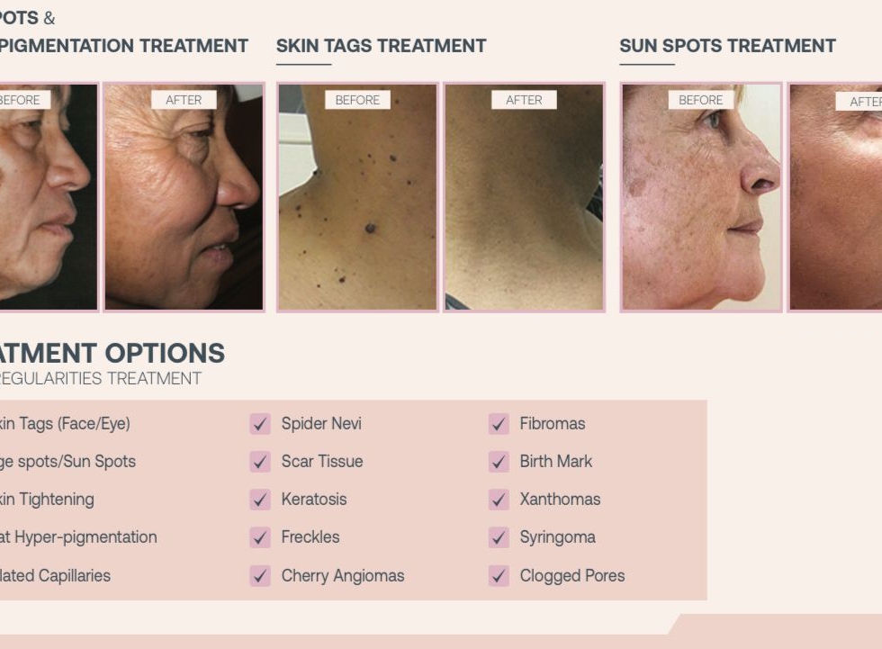 Skin Irregularities.jpg