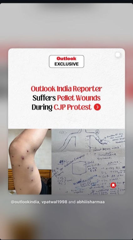 @outlookindia image /  Courtesy Instagram / Social Media